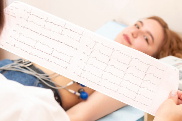 Pacientă conectată la ECG, medic ținând electrocardiogramă