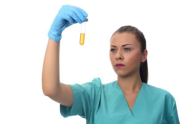 Sânge vizibil în urină: de ce trebuie evaluat chiar dacă dispare