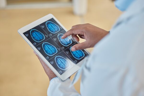 Mișcări involuntare: ce informații și înregistrări pot ajuta neurologul