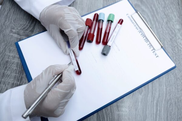 CRP și VSH normale exclud orice boală inflamatorie?