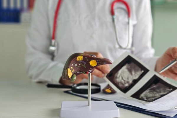 Ficat gras: ce înseamnă diagnosticul și cum se evaluează riscul