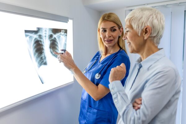 Screeningul cancerului pulmonar: de ce nu este recomandat identic tuturor
