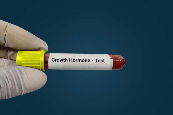 Hormonul de creștere: când se testează și de ce nu este un tratament cosmetic