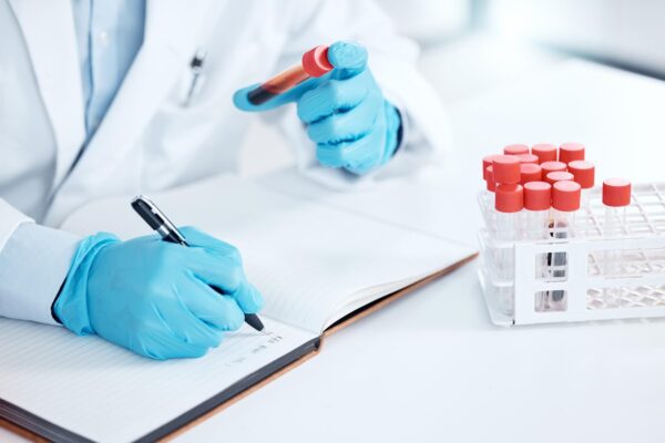 Sindromul antifosfolipidic: de ce diagnosticul cere criterii precise