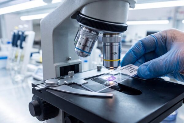 Biopsie pozitivă: ce informații sunt importante în rezultatul histopatologic