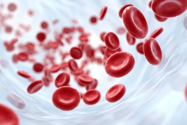 Anemia hemolitică: ce înseamnă distrugerea accelerată a globulelor roșii