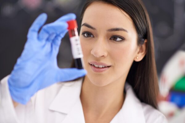 Hemoliza probei de sânge: de ce laboratorul poate cere o nouă recoltare