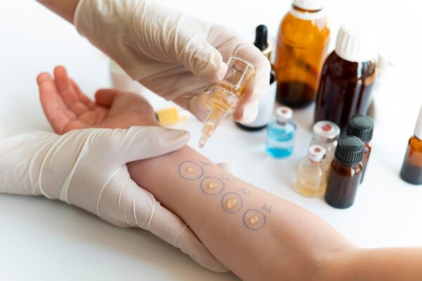 Imunoterapia pentru venin de insecte: cui i se poate recomanda