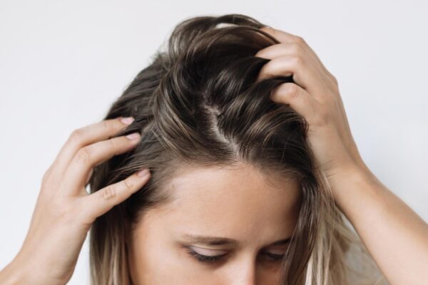 Scalp care mănâncă fără mătreață: ce cauze pot fi evaluate